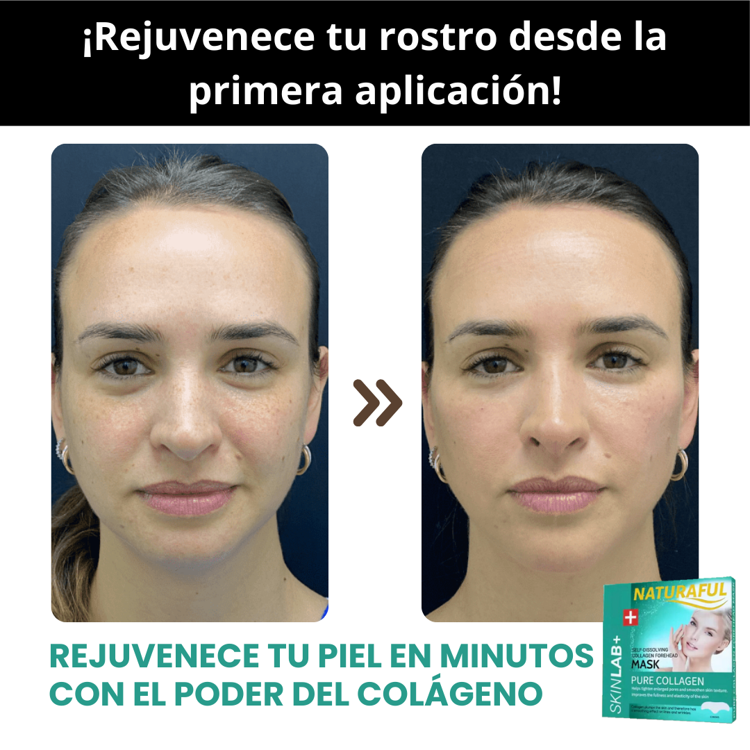 Parches De Colágeno Autodisolvente + Promoción Con Envío Gratis 🎁💖